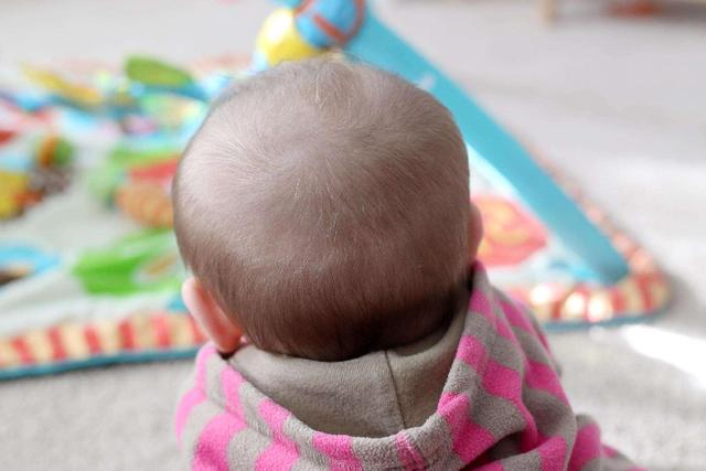 8个月女宝宝发量惹人忧，肉眼可见的稀薄，网友：娃不要面子的吗