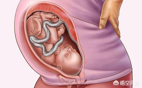 胎头在母体下腹部，为什么胎动会在右边？